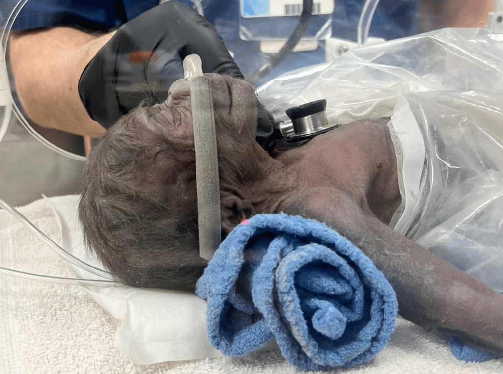 Baby gorilla being examined after c-section